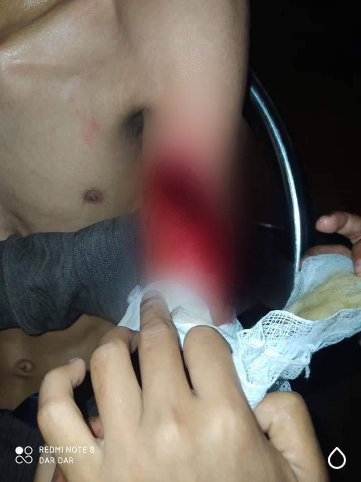 ShuMay25139230's tweet photo. Tw // death
In SouthDagon, Yangon:Military terrorists used hand grenades&amp;RPG. At least 10civilians has been killed and many got injured. Both mobile n wifi internet is known to be cut off in some areas of South Dagon. 
#InternetShutdown 
JUNTA MASSACRE
#WhatsHappeningInMyanmar https://t.co/pvpvVipI0D