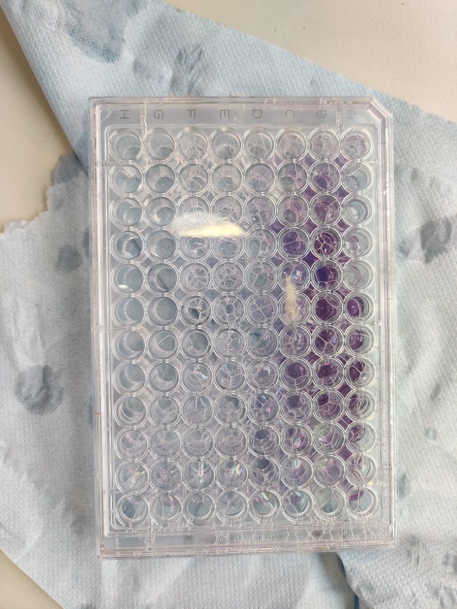 BioBenWest's tweet photo. Ever had one of those days where you drop a BCA assay just before you are about to image it? I did, it was over a week ago and I am still bitter! https://t.co/tdbhk4oMkD