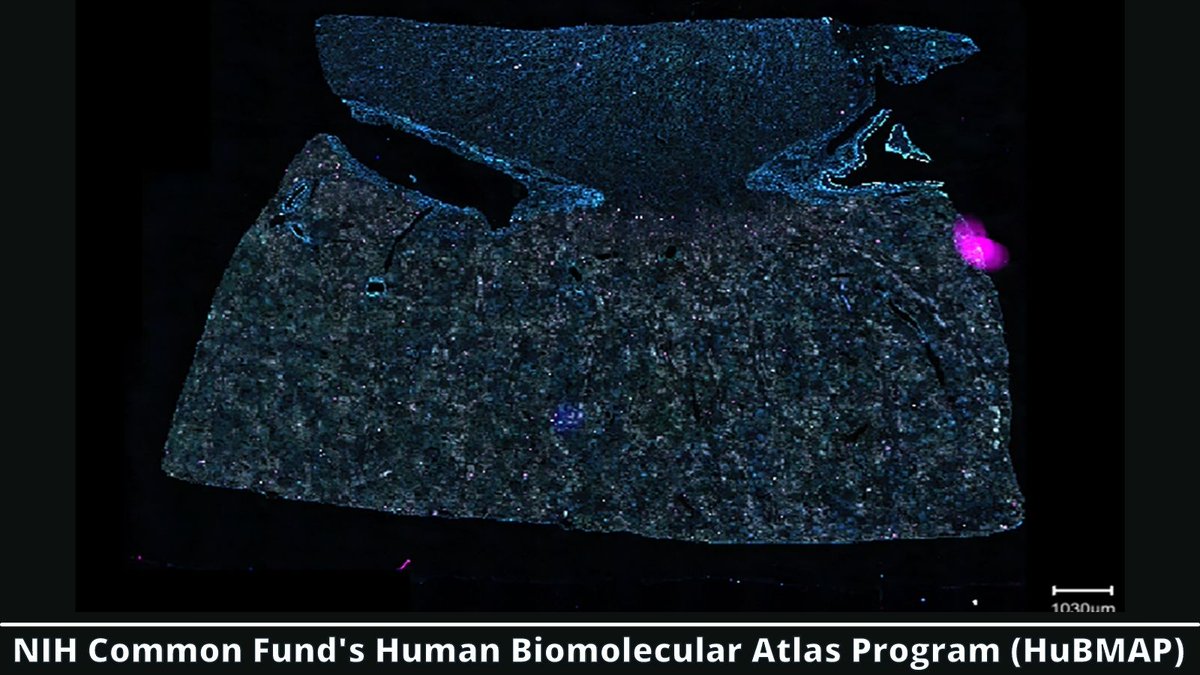 NIH Common Fund (@nih_commonfund) on Twitter photo Did you know your kidneys have native fluorescence? Dr. Elizabeth Neuman from @capriolilab at @vanderbiltu made this #autofluorescence image showing the cortex, medulla, glomeruli, and proximal tubules of the human kidney without any stains for <a href="/_hubmap/">Human BioMolecular Atlas Program (HuBMAP)</a>'s image of the week! Did you know your kidneys have native fluorescence? Dr. Elizabeth Neuman from @capriolilab at @vanderbiltu made this #autofluorescence image showing the cortex, medulla, glomeruli, and proximal tubules of the human kidney without any stains for <a href="/_hubmap/">Human BioMolecular Atlas Program (HuBMAP)</a>'s image of the week!