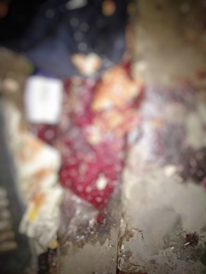 poemamhethar's tweet photo. Very alarming situation still going on📍South Dagon. No of death has come close to 10 including burst open head &amp; penetrating eyeball. Many are injured that death toll is rising.Its even hard to seek medical care as shooting goes continuously.
#WhatsHappeningInMyanmar #Mar29Coup https://t.co/o4CvtRDqN4
