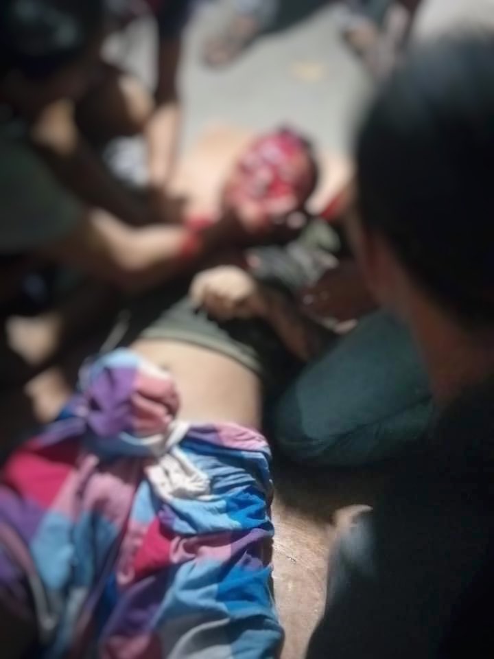 poemamhethar's tweet photo. Very alarming situation still going on📍South Dagon. No of death has come close to 10 including burst open head &amp; penetrating eyeball. Many are injured that death toll is rising.Its even hard to seek medical care as shooting goes continuously.
#WhatsHappeningInMyanmar #Mar29Coup https://t.co/o4CvtRDqN4