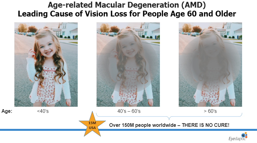 Eyedaptic's glasses have an adaptive user interface for hands-free autonomous usage, as well as a range of controls to customize the user experience.

Read about Eyedaptic at crowdfundingfinder.com/company/eyedap…

#crowdfunding #investment #InnovationForEveryone #technology #improvement