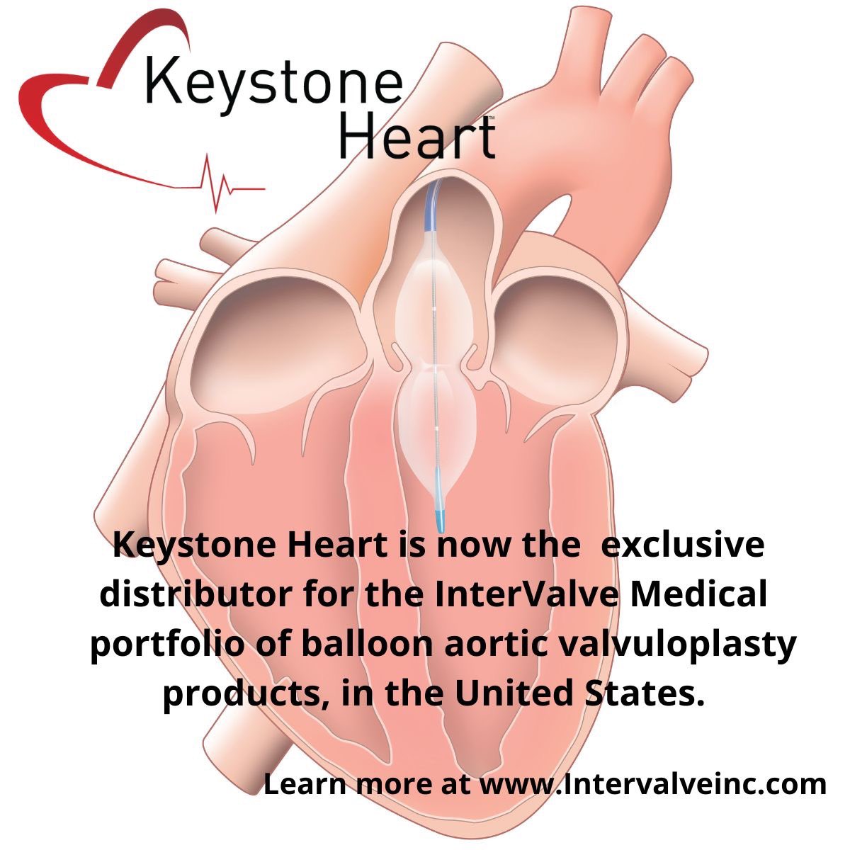 Keystone_Heart's tweet photo. #keystoneheart #intervalve #TAV8 #V8 #BAV https://t.co/7QZqdx2ONx