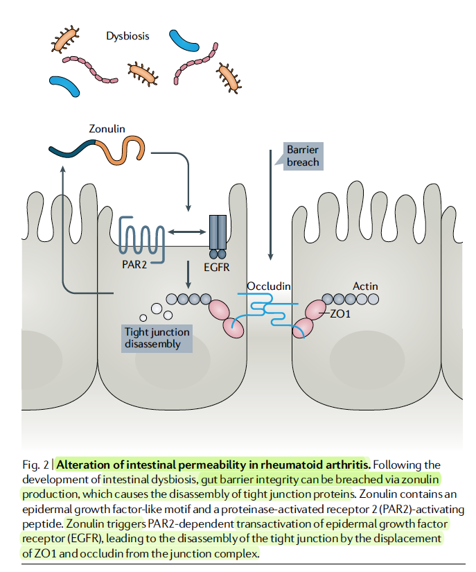 westr's tweet photo. The gut–joint axis in #rheumatoidarthritis @NatRevRheumatol
https://t.co/pF3UeQXKuR #microbiome #RA #rheum
"it seems likely that #dysbiosis already occurs before the clinical onset of disease and influences the development of #arthritis" #tightjunctions https://t.co/UWVA8sjBag