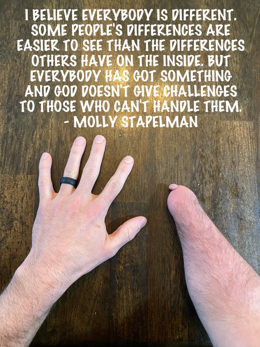 #motivationmonday 

#AirickFliesHigh #limbdifference #limbdifferenceawareness