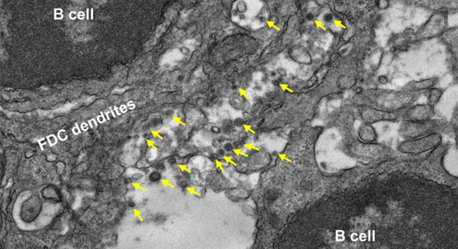 scrippsresearch's tweet photo. Early-stage results from Prof. Jiang Zhu’s lab show that an experimental #COVID19 #vaccine using virus-shaped particles to stimulate an #immune response performs well against three major “variants of concern” https://t.co/po2hJTekne @lab_zhu https://t.co/e0igOtkHCj