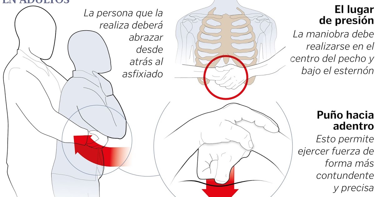 Si alguien sufre un atragantamiento➡ realizarle la maniobra de #heimlich puede salvarle la vida

¿Sabes cómo hacerla?👇