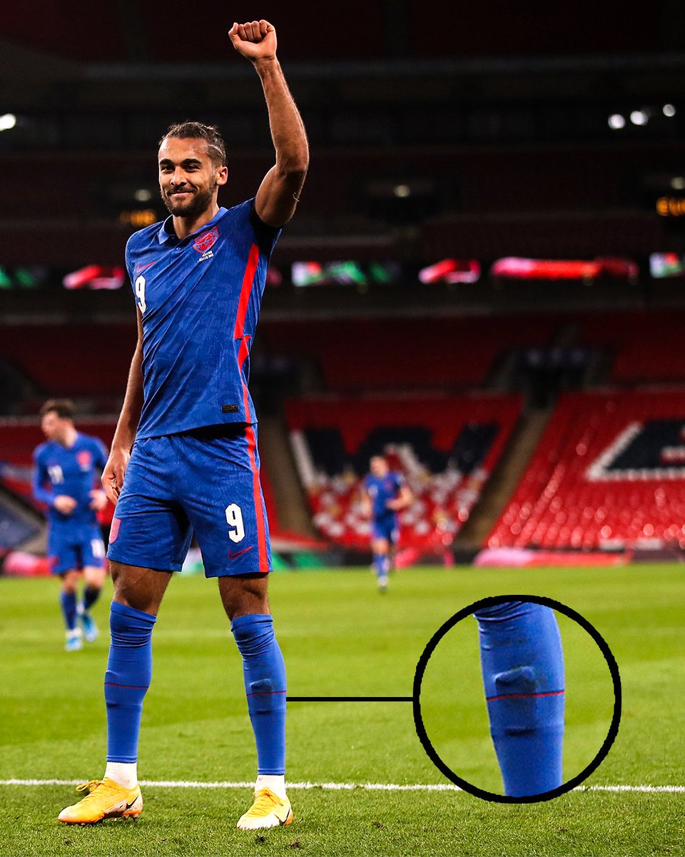 ESPNFC's tweet photo. These might be the smallest shin guards we've ever seen 🤣 https://t.co/ctWSagFEPg