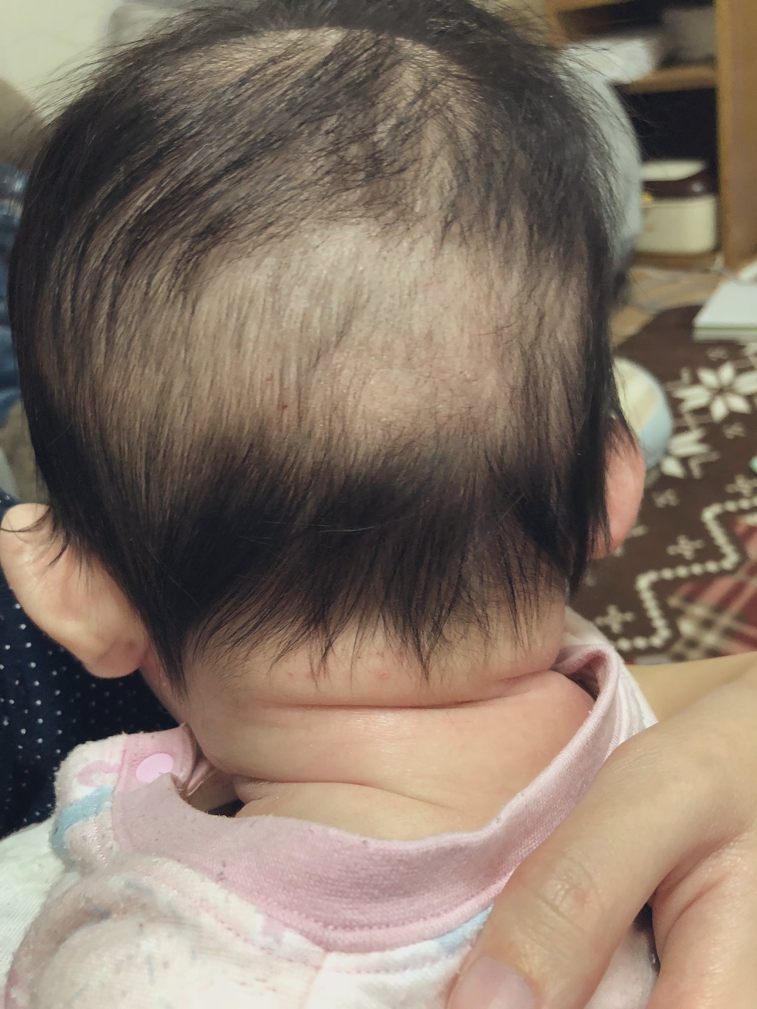 りーくん 寝返りできずに寝ハゲが進行していた3月5日から寝返りスムーズにできるようになった今日現在でこんなにも後頭部変わってビックリ 伸びるの早っ T Co Y9qsxufhdn Twitter