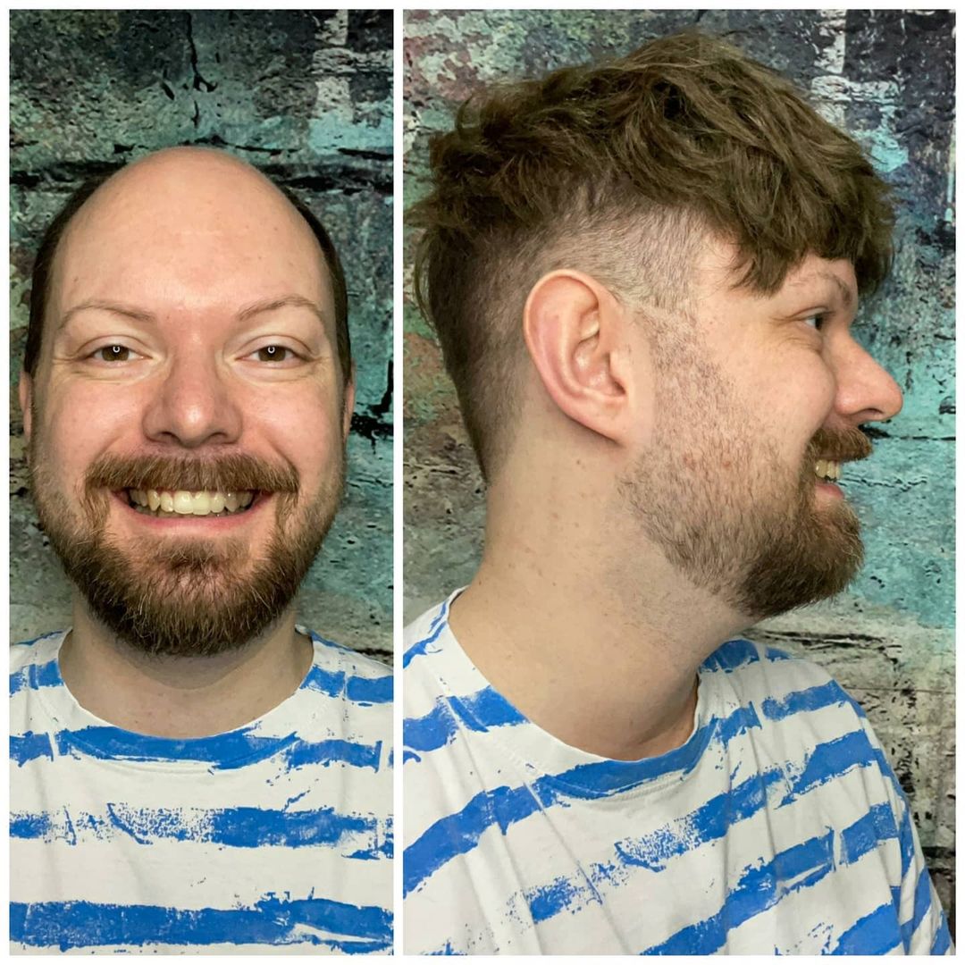 AddBeautymall's tweet photo. Would you love this top transformation?
.
.
.
.
.
.
.
.
.
#toupee #toupeeformen #hairline #hairlinerestoration #thinninghair #hairloss #hairlosssolution #hairfashion #hairsalon #hairstyle #wigsmanufaturer #toupeewholesaler #hairfactory #hairreplacementspecialist #addbeautymall https://t.co/zJzaZvjLG3