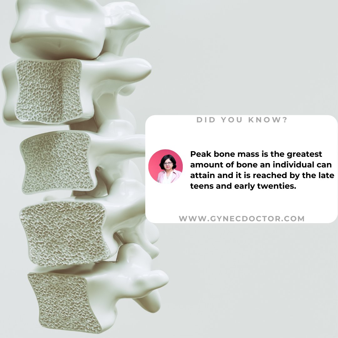 Gynec_Doctor's tweet photo. Peak bone mass is the greatest amount of bone an individual can attain and it is reached by the late teens and early twenties.

For more women, health-related tips visit our website:
https://t.co/qyMAQ7o6Mm

#gynecdoctor #bone #teens #teenstyle #peakbonemass #peakbone https://t.co/SNuwQ1HMjZ