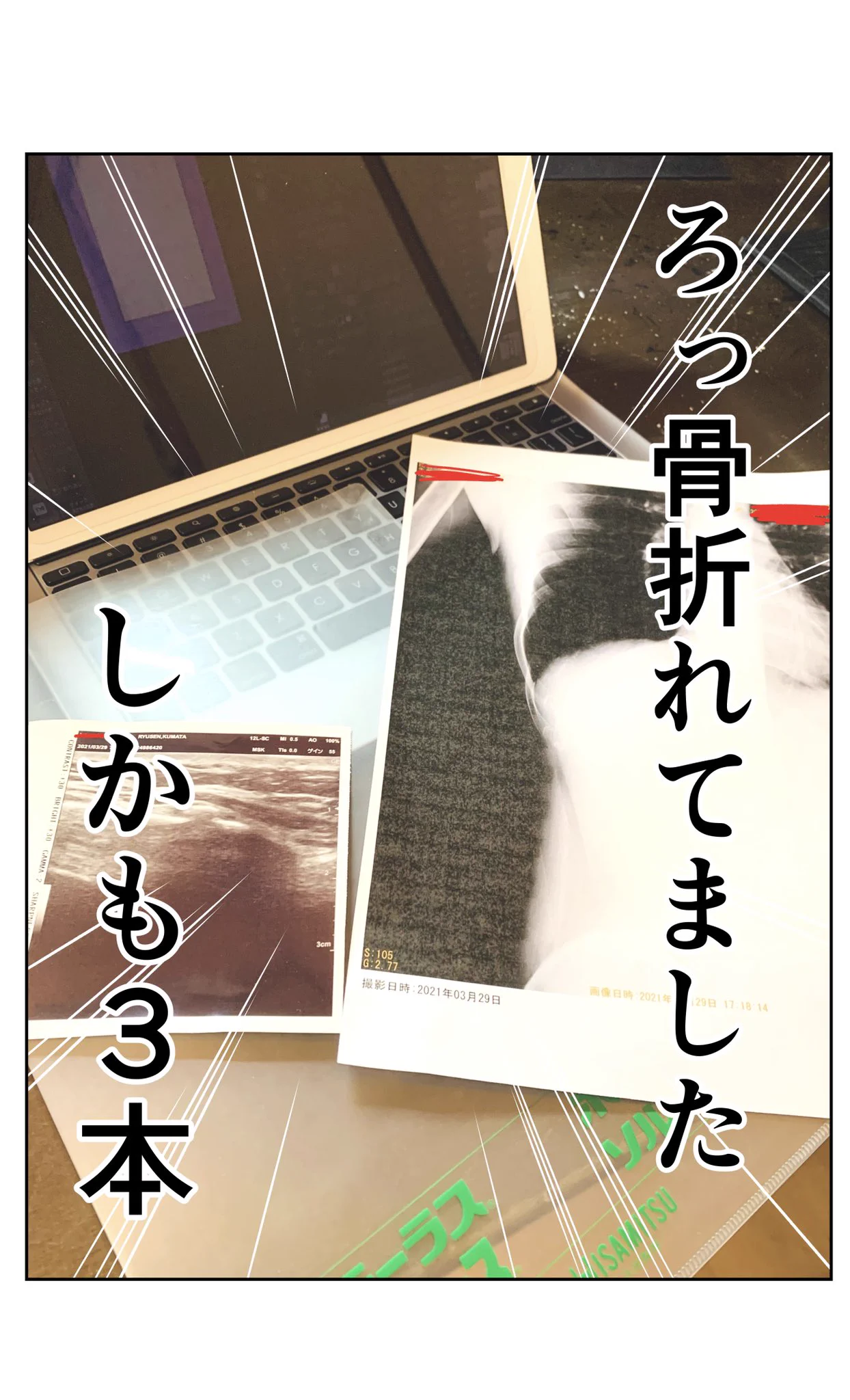 日頃の生活が大事？何もしていないのに骨折してしまうwww