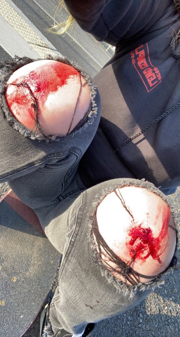 TAKING OUT THE THRASH #SESH https://t.co/EpPvuCcdMq<a href="/tag/sesh"class="tags">#SESH</a>