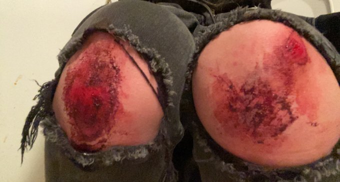 TAKING OUT THE THRASH #SESH https://t.co/EpPvuCcdMq<a href="/tag/sesh"class="tags">#SESH</a>