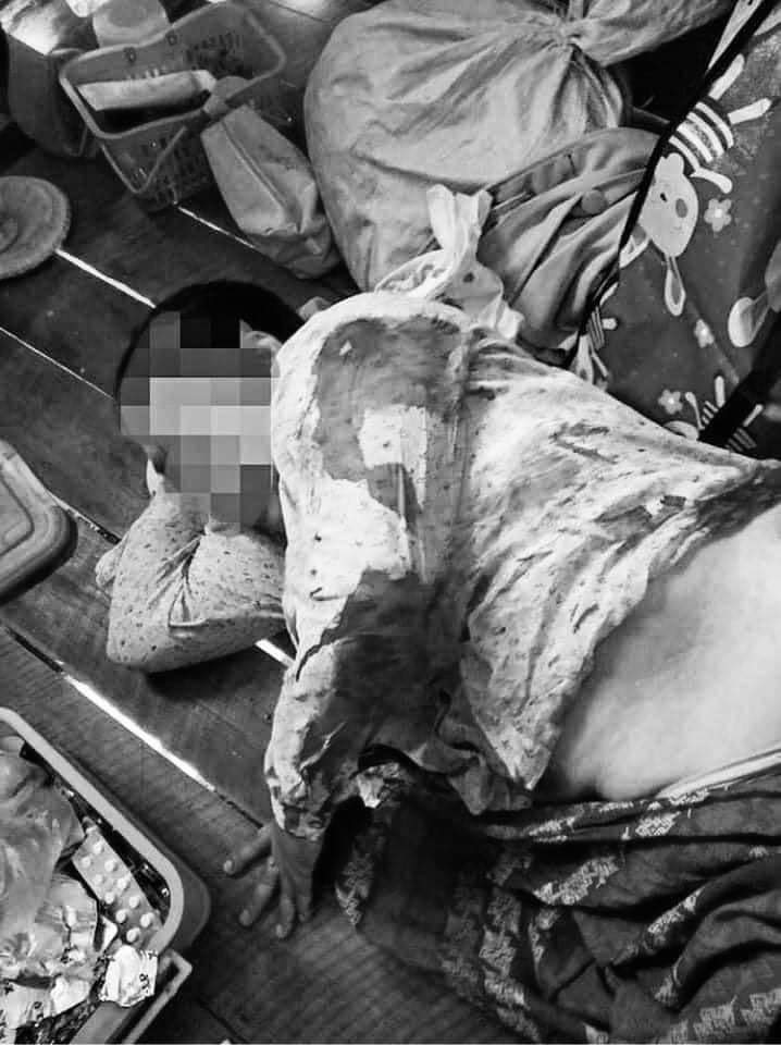 ChoZinLatt6's tweet photo. Tw // blood
Happened in Loikaw, Kayah State, An old woman staying in her house got shot with 9 rubber bullets and reportedly at least 3 people got injured .
ABOMINABLE CRUELTY
#Mar30Coup
#WhatsHappeningInMyanmar https://t.co/Gj2Vp7H9nv