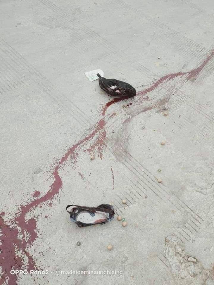 zayerlynn's tweet photo. Tw // blood // wound
In Muse, Shan State a man was shot in the head with sniper by junta’s terrorists.
ABOMINABLE CRUELTY
#WhatsHappeningInMyanmar 
#Mar30Coup https://t.co/tLvGNlcZBw