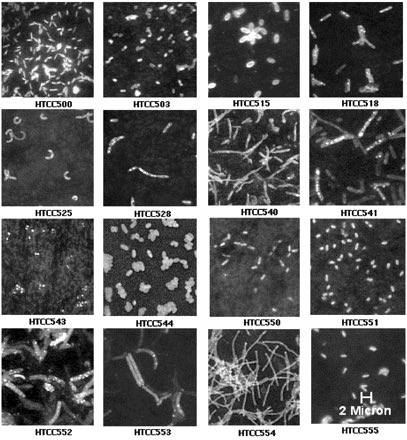 MsBiology_'s tweet photo. 3. Bacterioplankton| العوالق البكتيرية

عوالق جرثومية محدودة بتوافر الكربون العضوي، و تلعب دورا رئيسيا في السلاسل البايوكيميائية. https://t.co/Nn7XuClpza
