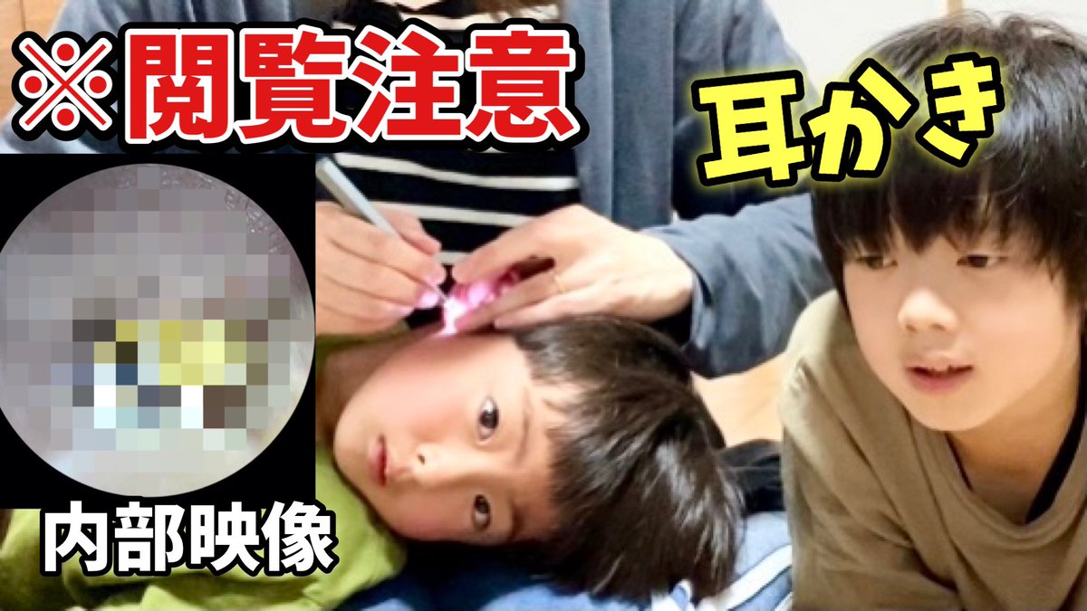こはたいちゃんねるのてっちゃん Kb6 T Little 今日の動画です 閲覧注意 カメラつき耳かきで耳掃除 をしたら超巨大な耳垢がごっそり 耳垢王は誰 T Co Pizjzexiic 噂のカメラ付き 耳かき こはたいちゃんねる Kohatai