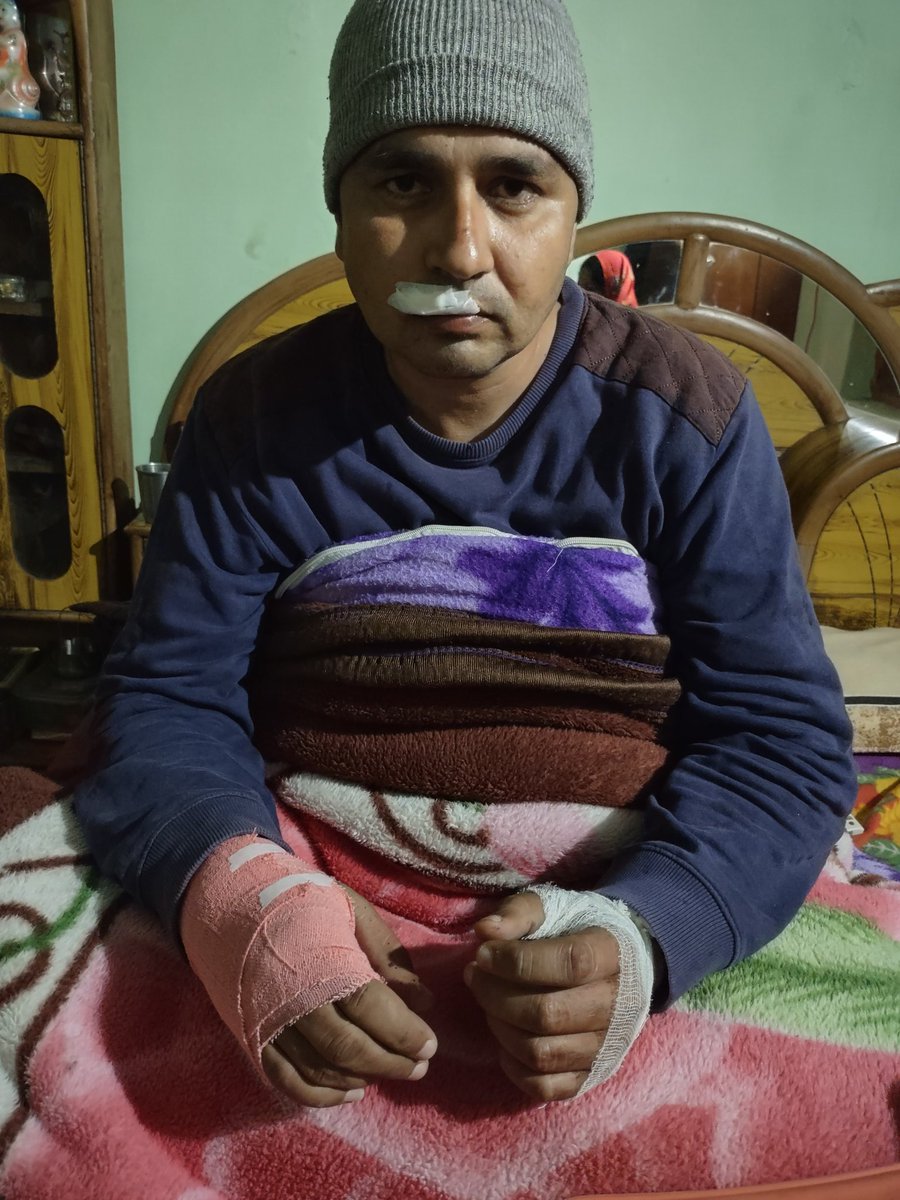 KumarVridul's tweet photo. @Flipkart your insurance partner  #JeevesCompleteSolution  still not convinced that the screen is damaged...Even proved my hand was also twisted in the same accident....Stop irritating customers in the name of Insurance....Henceforth wouldn't use @Flipkart anymore .....Keep https://t.co/CXQGwowSOU