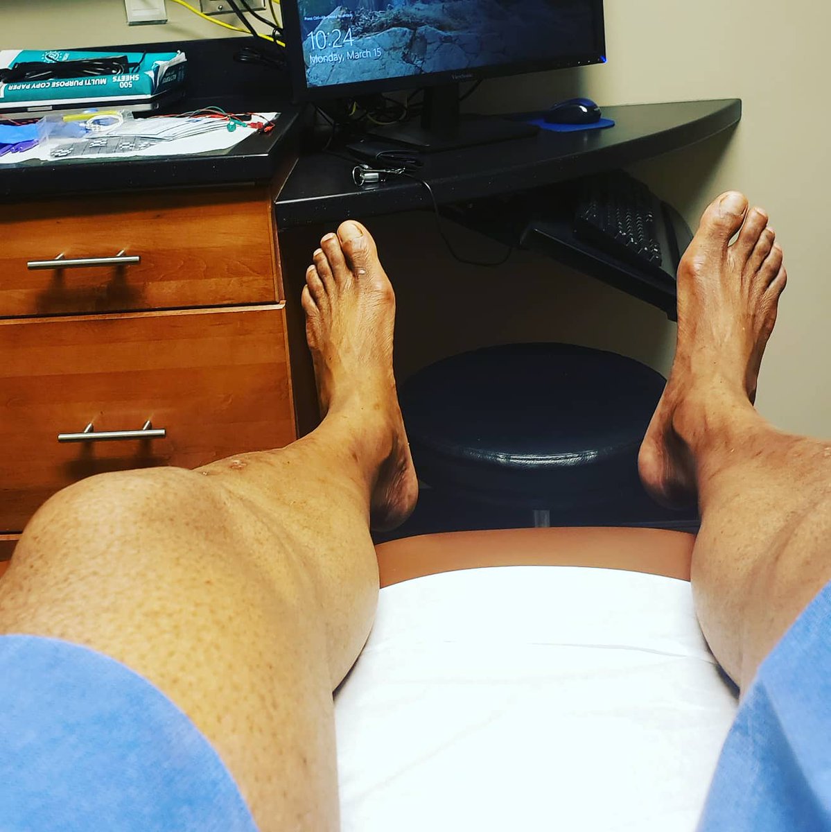 RonyDelgarde's tweet photo. I'm grateful and proud of the progress I am making. No matter how small.
My heartfelt thanks to all for supporting me.
#lowerbackpainrelief
#spinehealth #tallmanproblems
#tallmancantfittheframe
#begrateful #dontgiveup #yourhealthmatters #staypositive #patienceiskey https://t.co/6Y0BLTqMtg