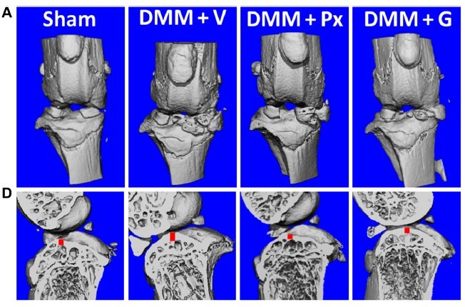 NIAMS (@nih_niams) on Twitter photo “Paroxetine-mediated GRK2 inhibition is a disease-modifying treatment for osteoarthritis” stm.sciencemag.org/content/13/580… Abstract only. Full access requires subscription or payment. #NIAMSResearch <a href="/PennState/">Penn State News</a> <a href="/ScienceTM/">Science Translational Medicine</a> Other funding: <a href="/NIDDKgov/">NIDDK</a> <a href="/ncats_nih_gov/">NCATS</a> <a href="/CureArthritis/">Arthritis National Research Foundation</a> “Paroxetine-mediated GRK2 inhibition is a disease-modifying treatment for osteoarthritis” stm.sciencemag.org/content/13/580… Abstract only. Full access requires subscription or payment. #NIAMSResearch <a href="/PennState/">Penn State News</a> <a href="/ScienceTM/">Science Translational Medicine</a> Other funding: <a href="/NIDDKgov/">NIDDK</a> <a href="/ncats_nih_gov/">NCATS</a> <a href="/CureArthritis/">Arthritis National Research Foundation</a>