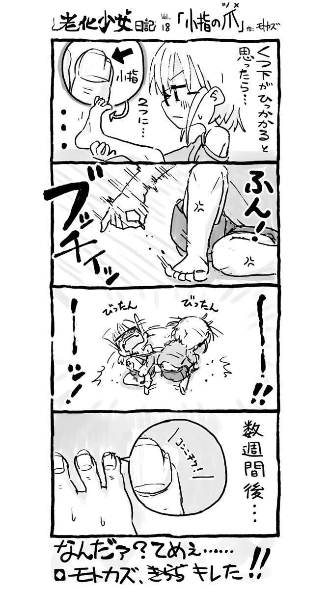 #老化少女モトカズ Vol.18 「小指の爪(つめ)」 