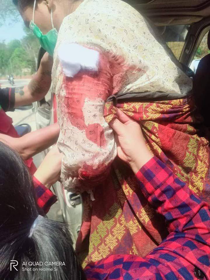 Zinlayy3's tweet photo. Tw // Blood ,Wounded 
In #Loikaw, Kayah State, this morning. Due to terrorists' violent crackdown, An elderly woman living in her home was shot by at least nine rubber bullets.
#WhatsHappeningInMyanmar
#Mar30Coup https://t.co/QPP7oY3rYS