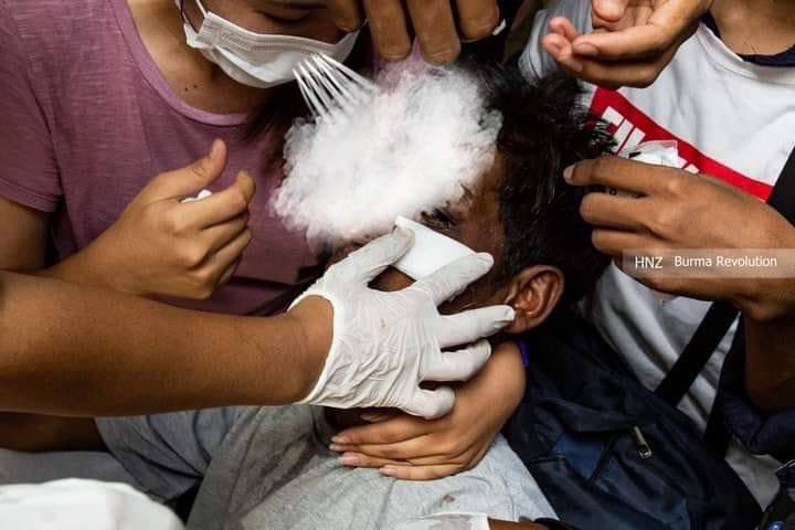 Military junta terrorists made a deep cut to the face of a non-protesting trishaw driver with a knife in YanPyay Ward, TharKayTa this morning. He was then abducted and released just now.
ABOMINABLE CRUELTY
#WhatsHappeningInMyanmar  
#Mar30Coup