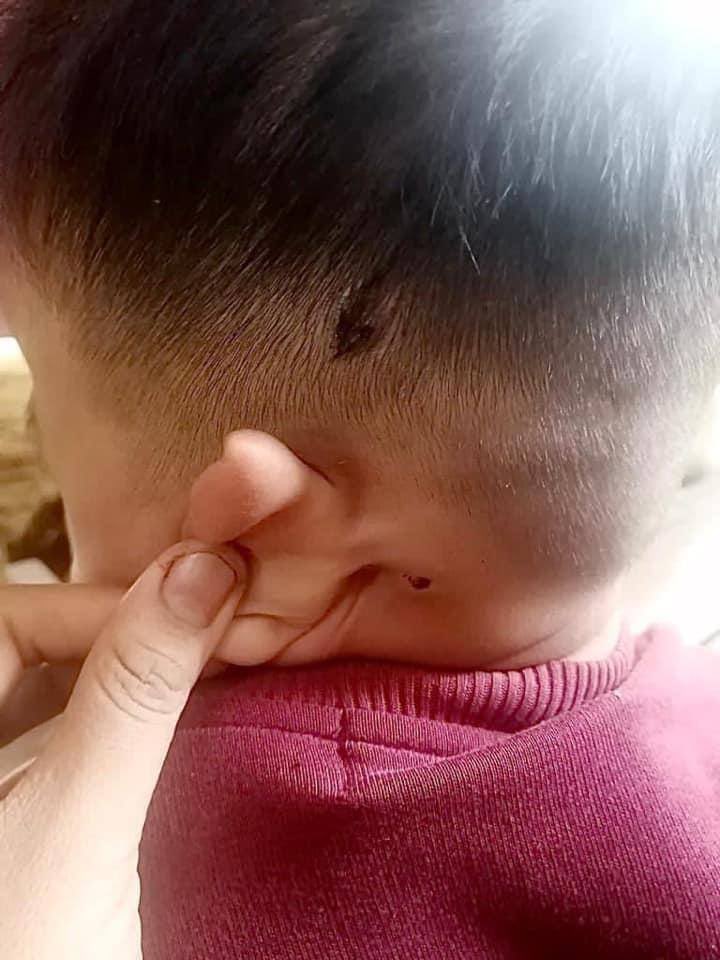 OoAyeThida21's tweet photo. This little boy was on his father's lap when the military terrorist forces dropped bombs on a ward in Karen State. The father died on the spot and the boy got injured. 
ABOMINABLE CRUELTY
#WhatsHappeningInMyanmar  
#Mar30Coup https://t.co/rsvGwY9SEj