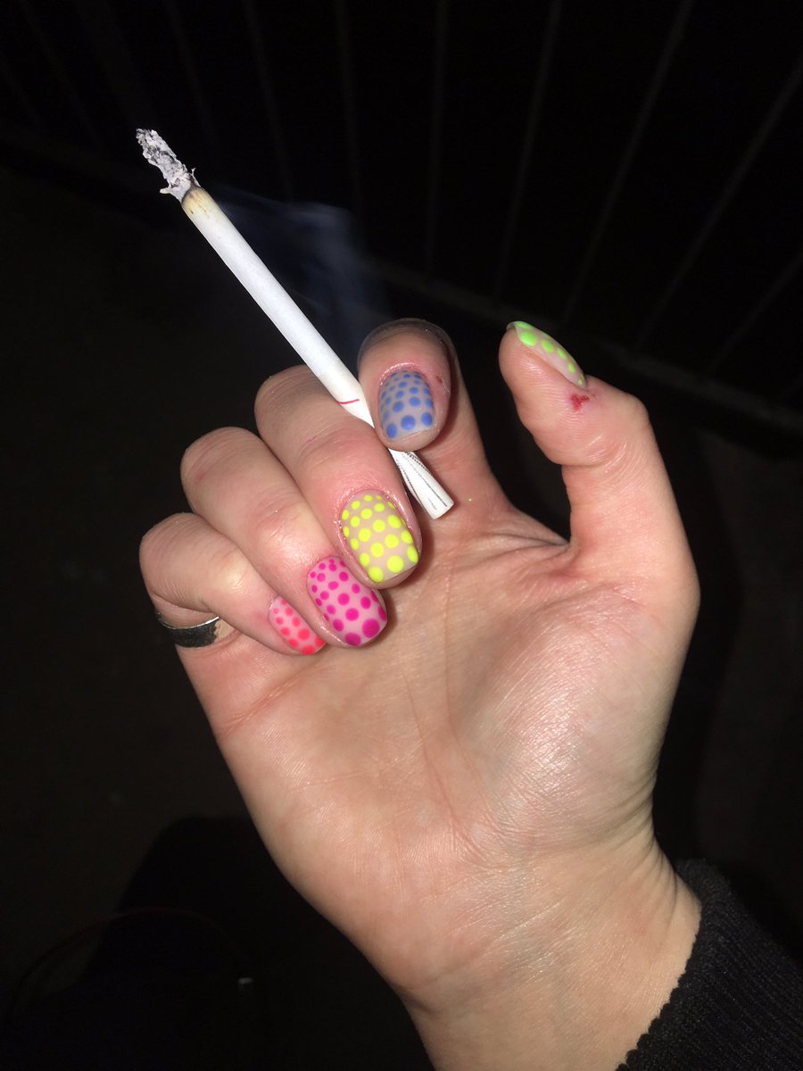aKillerQueen_'s tweet photo. проиграла в драке с заусенцами https://t.co/cg1MDOUGbn