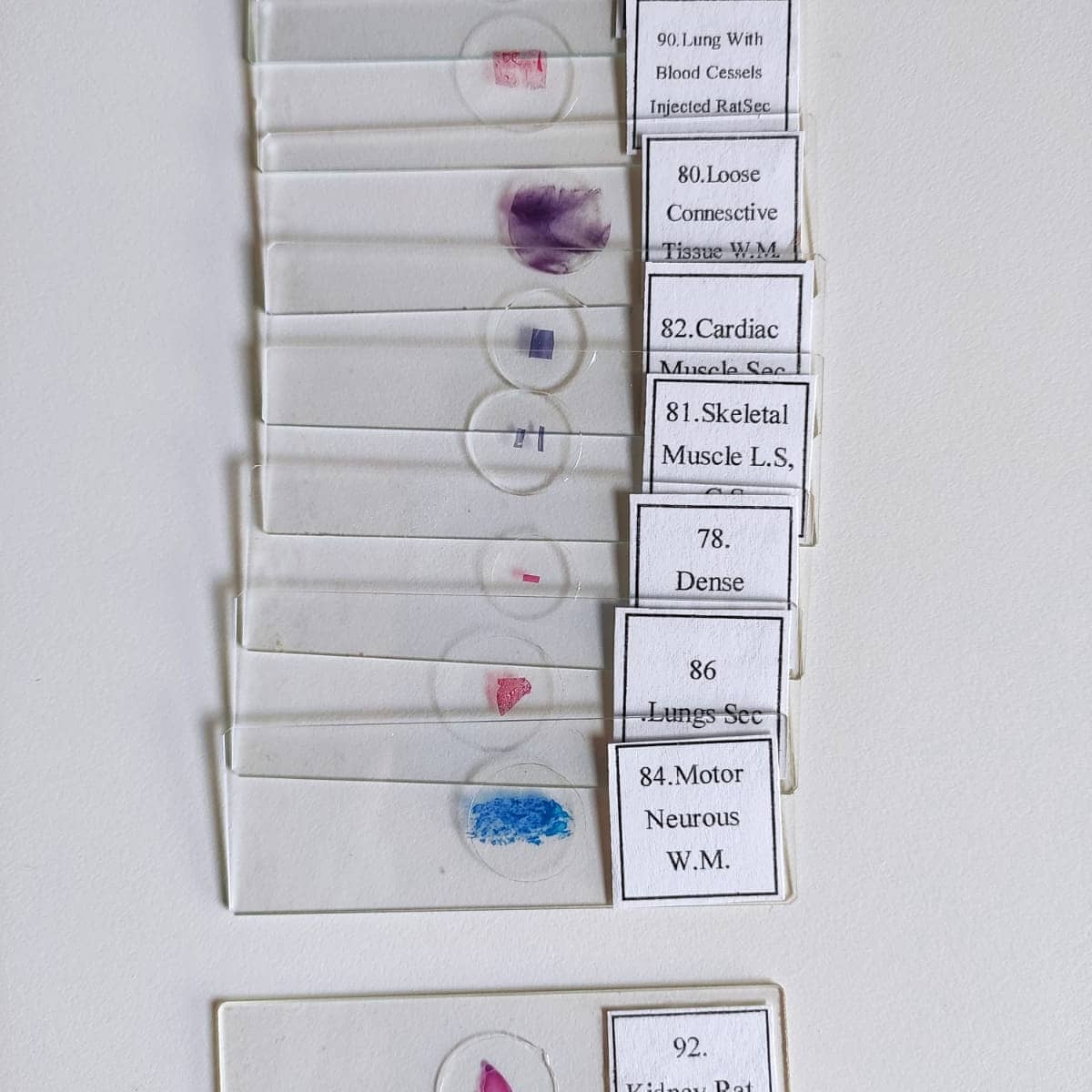 sdbpaderno's tweet photo. Attività con il microscopio e osservazione di vetrini anche a distanza #quantecosedaimparare #stem #microscopia https://t.co/RhYerrKJe3