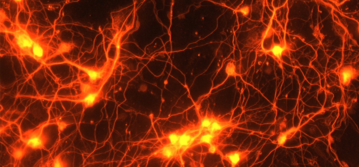 BCMFromtheLabs's tweet image. From the @Wu_Lab_Baylor, @DrYongXu1 et al #MolecularPsychiatry: Correcting altered #brain circuit could tackle coinciding #obesity and #depression #mouseModel @bcmhouston sciencedaily.com/releases/2021/…
