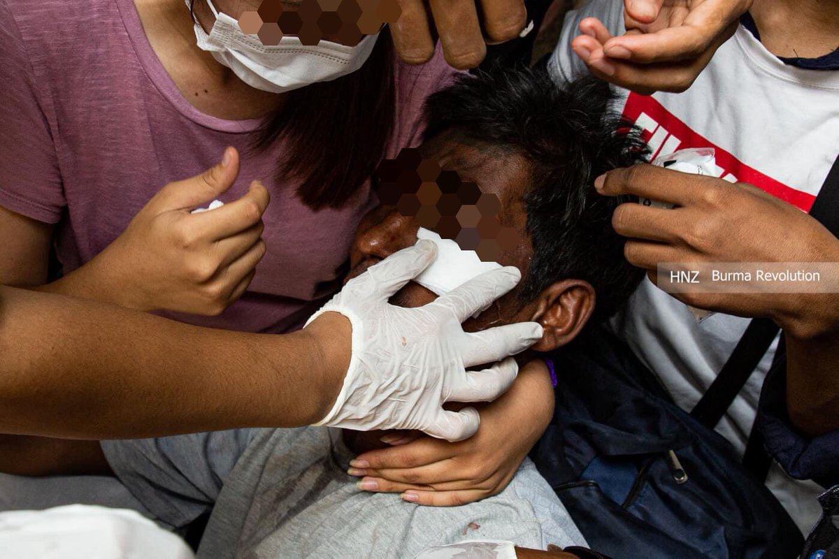 KhaingEiKhaing's tweet photo. An Inhumane act made by military terrorists at Yan Pyae, Thaketa , Yangon. They stopped a passerby who was riding a trishaw, cut his face with knife and only then released.

ABOMINABLE CRUELTY
#WhatsHappeningInMyanmar  
#Mar30Coup https://t.co/vHLUk04ofE https://t.co/KGF2LeEN87