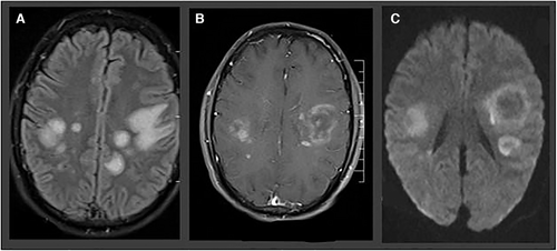 JNeuroimaging's tweet photo. Happy #NationalDoctorDay from @JNeuroimaging! With gratitude to everyone on the front lines and behind the scenes using #neuroimaging to help fight #COVID19, like this excellent review that helps guide us through the #pandemic. #neurotwitter #match2021 https://t.co/802ejTr78d https://t.co/GRMDQYT00X