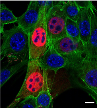 CIBSS_UniFR's tweet photo. Enjoy this #fluorescentfriday pics by @zhao_bing from #cibss: He used #optogenticswitches to move proteins out of the nucleus. This #controloffunction tech shows how transcription factor MRTF‐A dynamics are connected to the #cytoskeleton @grosse_lab  https://t.co/qRtwNNQxd2 https://t.co/BAjn0G2lrg