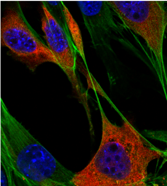 CIBSS_UniFR's tweet photo. Enjoy this #fluorescentfriday pics by @zhao_bing from #cibss: He used #optogenticswitches to move proteins out of the nucleus. This #controloffunction tech shows how transcription factor MRTF‐A dynamics are connected to the #cytoskeleton @grosse_lab  https://t.co/qRtwNNQxd2 https://t.co/BAjn0G2lrg
