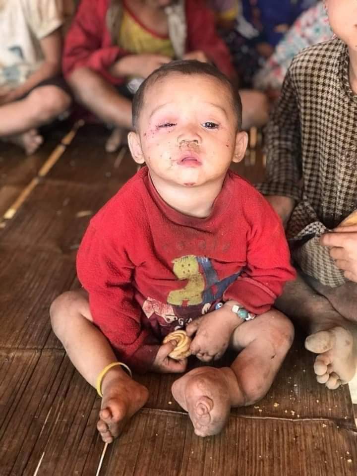 Byun_Sori6104's tweet photo. A little baby fleeing from military regime's airstrike 💔💔

#WhatsHappeningInMyanmar 
#Mar30Coup https://t.co/2JC6BiYe9p