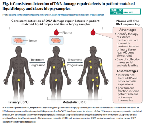 NatRevUrol's tweet photo. #NEWinNRU in this News&Views Sarah W. S. Ng & @ResearchWyatt discuss circulating tumour DNA assays for metastatic castration-resistant #ProstateCancer https://t.co/TVFKgkUC8R https://t.co/MxE6nPVHS5
