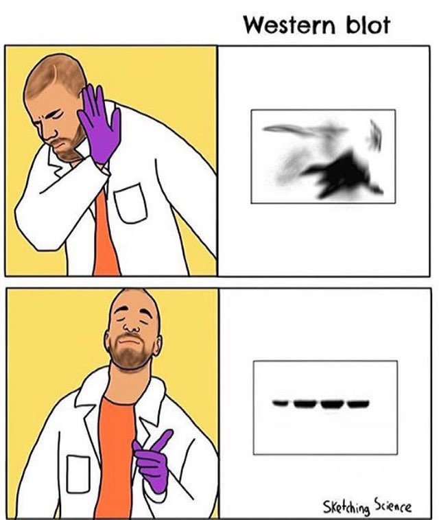 Me doing a lab last week with a gel looking similar to the one on the top 😭