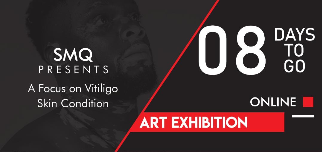 It could be true that little is known about Vitiligo,a skin condition and the victims have since endured social challenges but then, @MartinSenkubuge presents a focus on this skin condition. 
Come attend this Art Exhibition on  07.04.2021
#SMQ #ArtOnTop #vitiligo