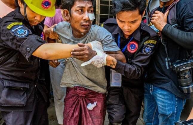 EaNhi1's tweet photo. The trishaw pedaller who was passing by the street was called in by the terrorists and stabbed in the face, more than an inch injuring his insides in Thakayta, Yangon.
#Mar30Coup 
#HumanRightsViolations
#WhatsHappeningInMyanmar #WeNeedR2PInMyanmar 
#R2POurselves https://t.co/OGHwrHEYn7
