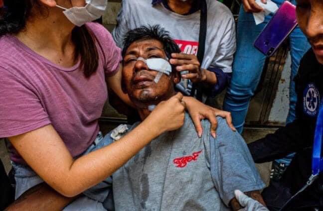 EaNhi1's tweet photo. The trishaw pedaller who was passing by the street was called in by the terrorists and stabbed in the face, more than an inch injuring his insides in Thakayta, Yangon.
#Mar30Coup 
#HumanRightsViolations
#WhatsHappeningInMyanmar #WeNeedR2PInMyanmar 
#R2POurselves https://t.co/OGHwrHEYn7