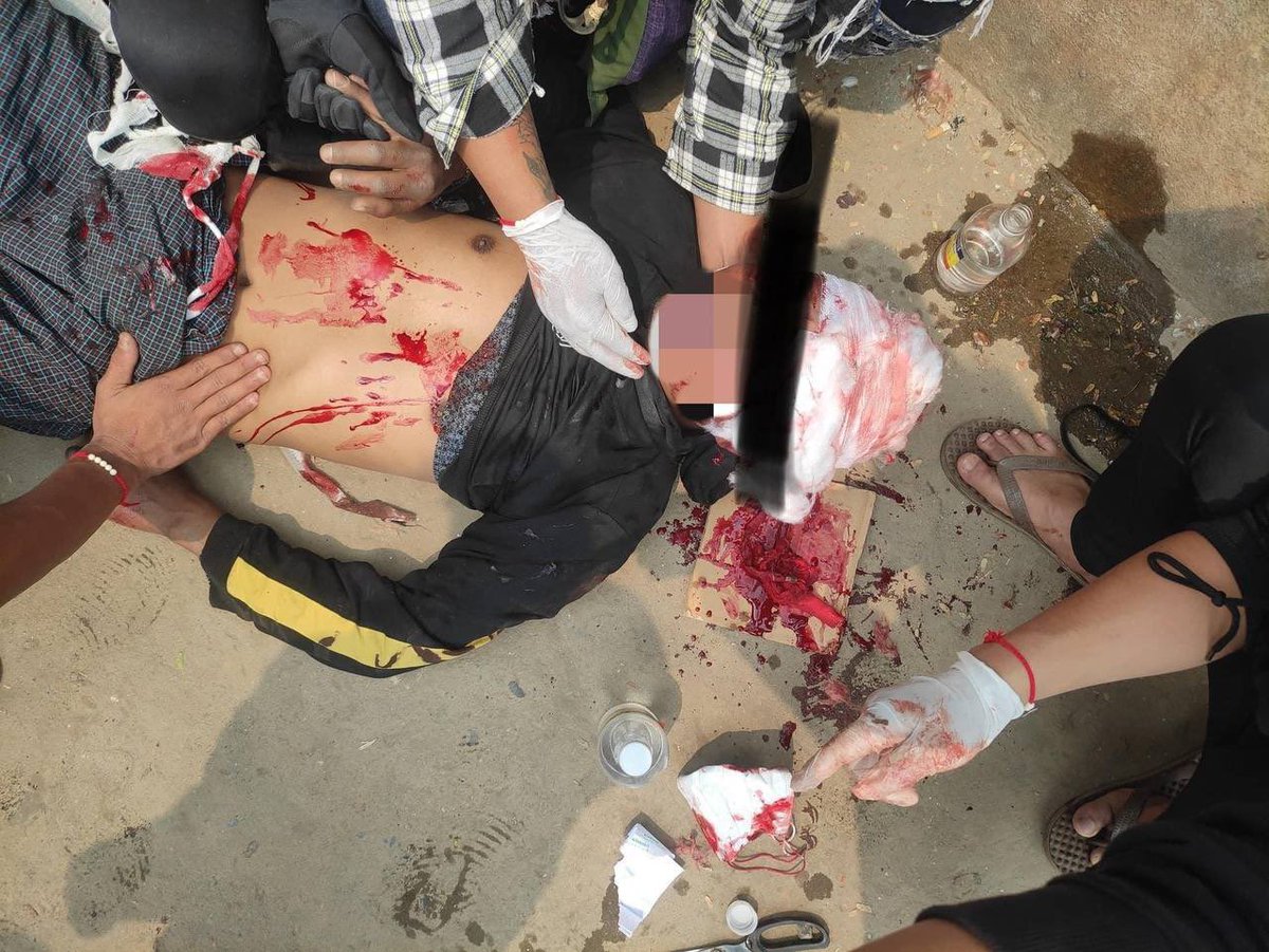 kyii_jpeg's tweet photo. Tw // blood // wound
In Muse, Shan State a man was shot in the head with sniper by junta’s terrorists.
ABOMINABLE CRUELTY
#WhatsHappeningInMyanmar 
#Mar30Coup https://t.co/MU5IPIDhzK