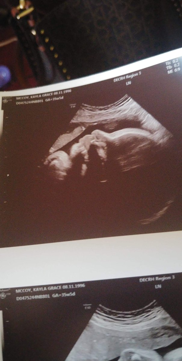 scorpio_mama96's tweet photo. How am I supposed to bring you into the world and come home without you?.. I'm sorry I couldn't keep you safer for longer. I'm so sorry my body failed you💔 I love you Malakai Everett Spicer. Forever.💔😭😭 https://t.co/Zj4y1fb85a