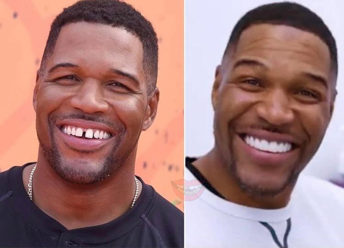 SaycheeseDGTL's tweet image. Michael Strahan has officially closed his iconic gap!