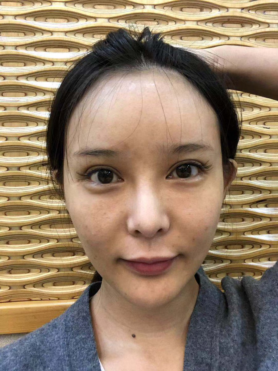 陳整形外科のtwitterリアルタイム検索結果 Meyou ミーユー