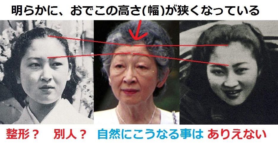 Usapyon 美智子様はあきらかに時代によって身長が違います 愛子様 も違う方もいらっしゃいますね チェロを弾く方とか 眞子さまの婚約会見に至ってはお二人共別人です 佳子様と雅子様は本物でしょう この方々は男系がどうのこうのと言っても表の方々