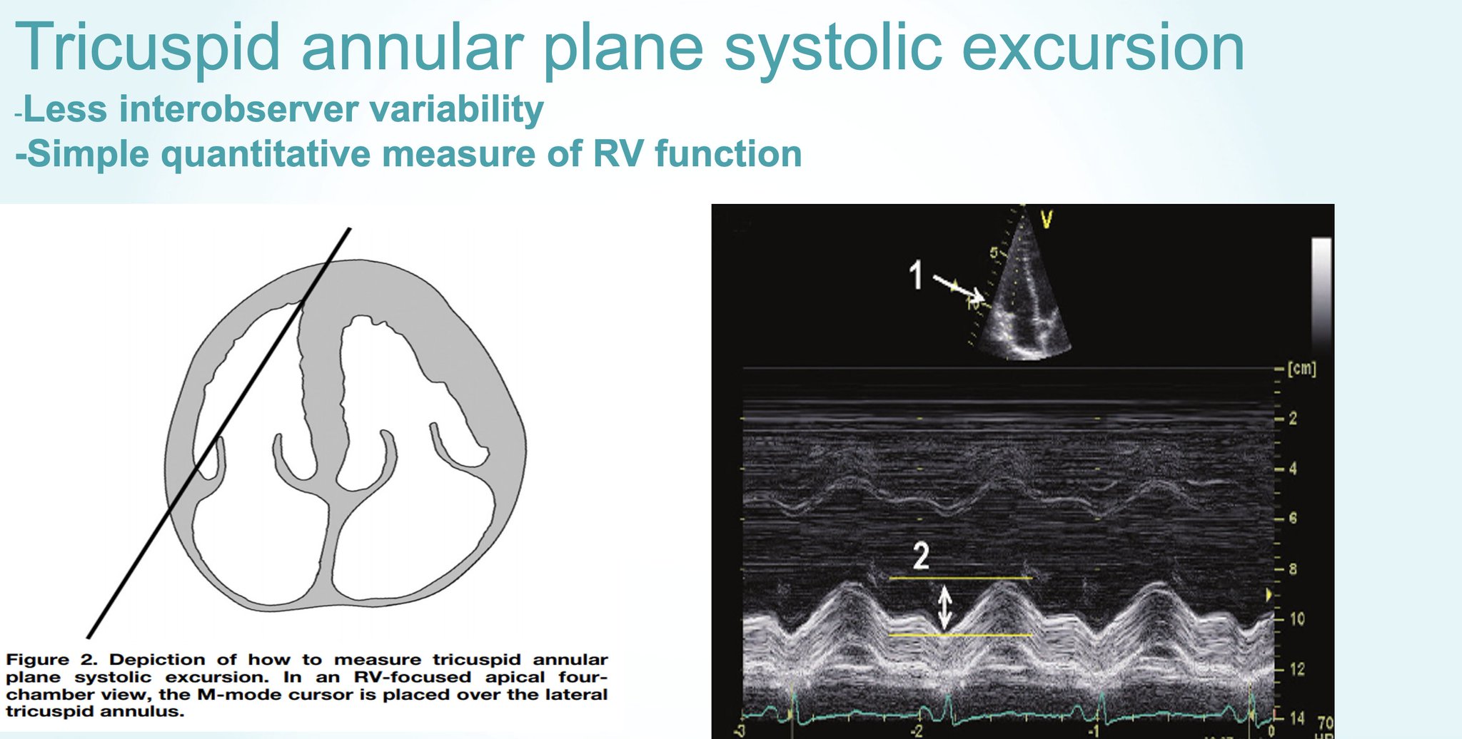 Validation of the Tricuspid Annular Plane Systolic Excursion