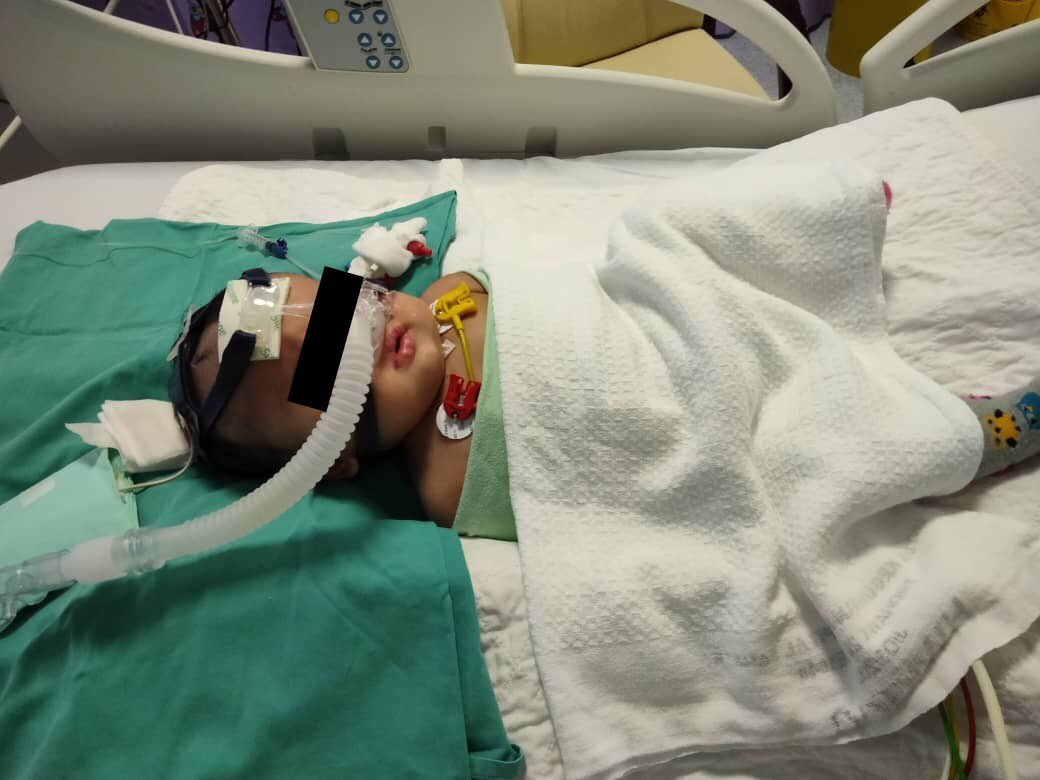 zumairaaa's tweet photo. Korang semua, mintak share/RT kan tabung bantuan untuk adik Safiyyah ni boleh tak💔🥺🙏

Adik Safiyyah tengah menderita sakit sebab jantung berlubang. Sekarang memang totally bergantung pada bantuan penafasan. Doctor sahkan yang adik Safiyyah ni kena operate pasang VP SHUNT😖😢 https://t.co/DIHSIQ4uun
