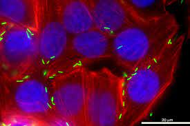 Stopping the sickness: #Protein may be key to blocking a nauseating #bacterium. Researchers have discovered a protein that could be key to blocking the most common bacterial cause of human #foodpoisoning in the United States.